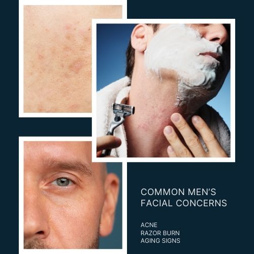 Common Men’s Facial Concerns