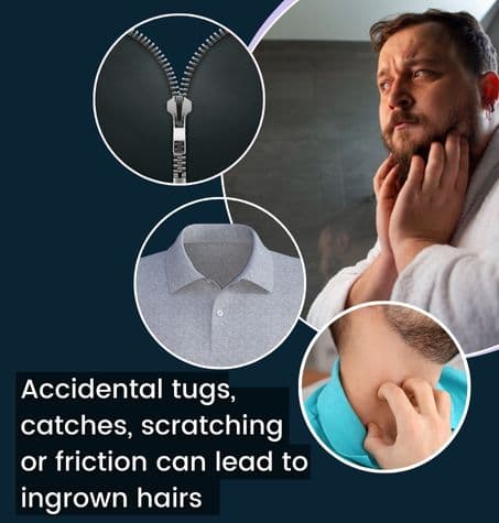 a man examining his beard in the mirror, with small icons depicting a zipper, shirt buttons, and an itchy neck