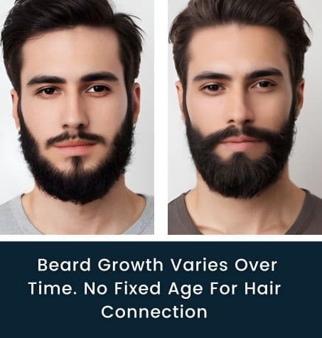 comparison: evolution of beard growth from sparse to full coverage over time, text overlay says Beard Growth Varies Over Time.