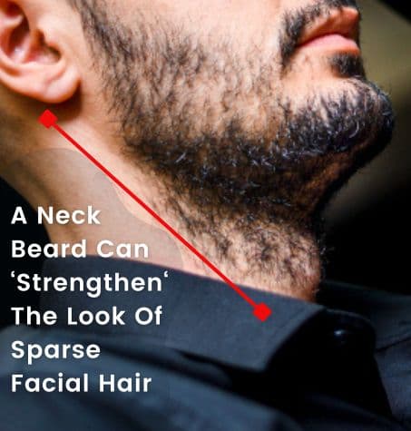 Man with dense, chiseled neckbeard. Adds fullness, warmth