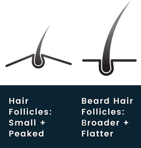 comparison Scalp hair follicles small and peaked, facial hair follicles broader and flatter,