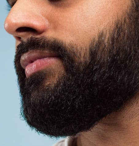 _a close-up of a beard with dense and thick coverage, highlighting the appearance of multiple active beard hair follicles