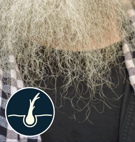 a close-up of dry and damaged beard hair with visible split ends.
