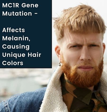 a man with MC1R Gene Mutation Strawberry blonde scalp hair and vibrant red beard hair,