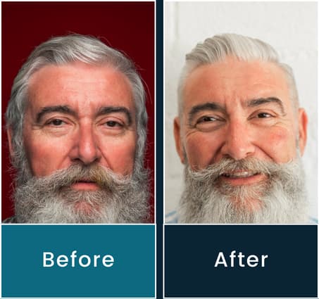 combover before and after