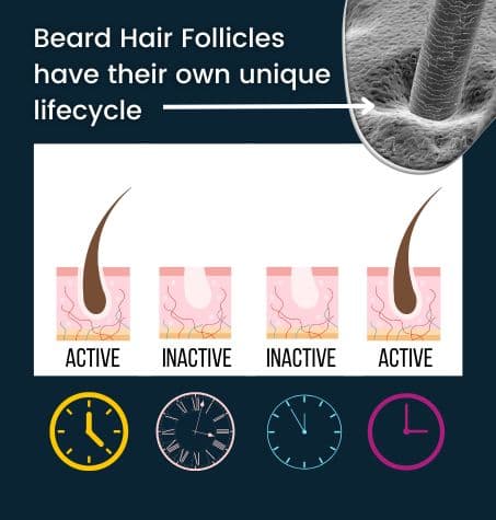 illustration: acitve beard follicles with hair inactive beard hair follicles. without hair. clock faces show different times