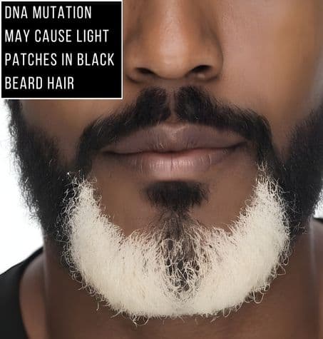 handsome Africa man With White patches in black beard. overlay reads DNA mutation may cause light patches