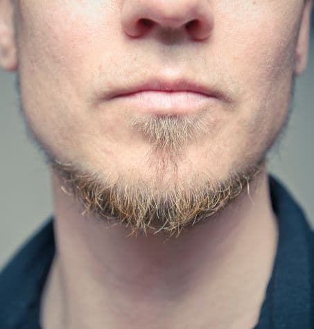 man with light colored hair, chin strap beard growing along jaw line