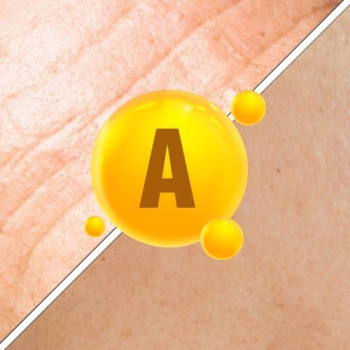 retinoid acts as an antioxidant to protect against free radicals