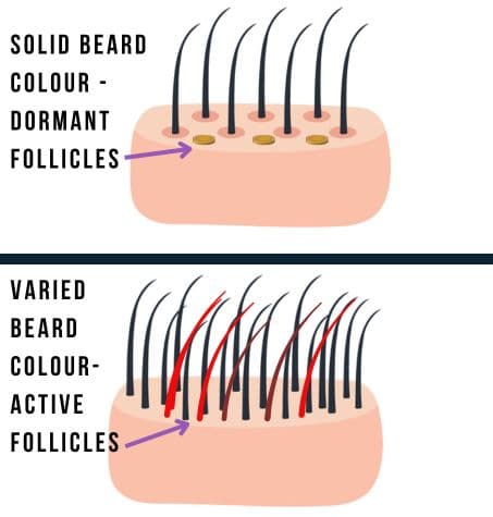 compairson of section of beard hair: solid beard colour and dormant follicles versus varied beard hair colors