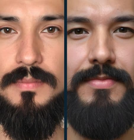 comparison of bearded man. on left image thin and sparse goatee and moustache. on the right image beard hair is full and thick