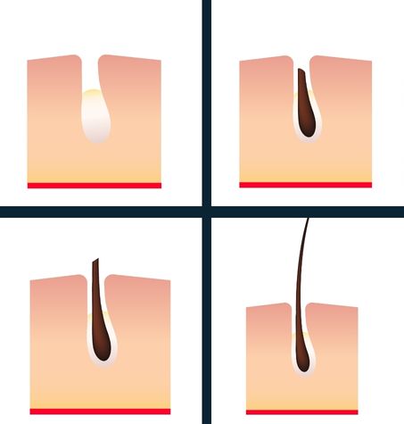 infographic: skin follicle regeneration