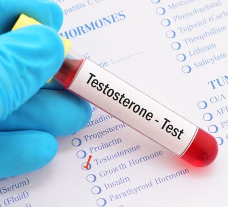 Testostetorne labelled test tube - lab test