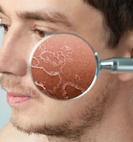 close up of damaged facial skin