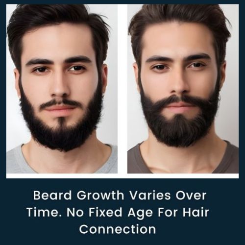 Evolution of Beard Growth from Sparse to Full Coverage over Time, Text Overlay Says Beard Growth Varies over Time.