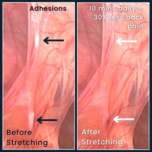 On the left a cluster of muscle fibers with small, visible “adhesions”. Labelled “Before Stretching.” On the right, the same muscle fibers after stretching, where those adhesions are absent. Labelled “After Stretching.”