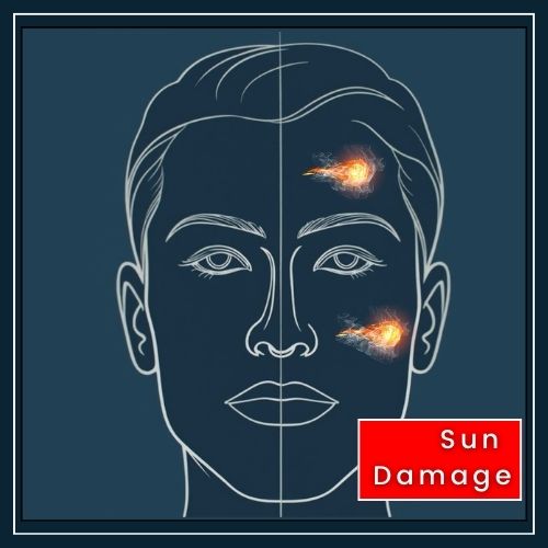 a straight-on outline of a man’s face divided down the middle by a thin, vertical line. On one side, shaded areas indicate sun damage