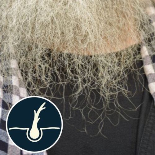 a close-up of dry and damaged beard hair with visible split ends.