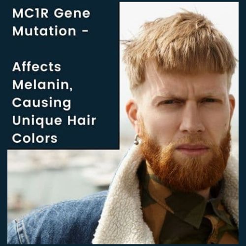 a man with MC1R Gene Mutation Strawberry blonde scalp hair and vibrant red beard hair