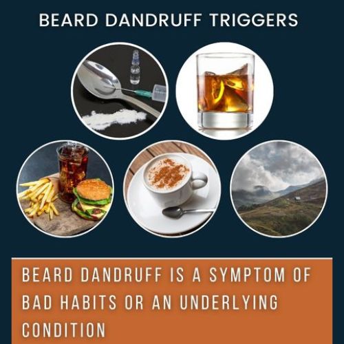 beard dandruff triggers including food drink and weather