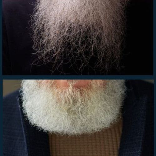 split comparison: well maintained beard versus beard with split ends