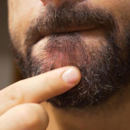tender-to-touch-skin-underneath-beard