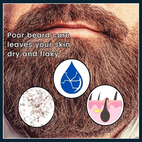 a bearded man with three small icons over his beard—a cracked water droplet for dryness, a flake for beardruff, and an ingrown hair icon - highlighting that a beard's microclimate can lead to uncomfortable skin issues."
