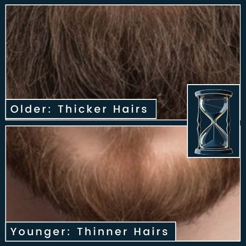 a split-screen design on a plain background with two magnified close-up images of beard hairs: Top Side: A close-up of an older man's beard, showing thicker, wiry, and coarser strands. Labelled “Older: Thicker Hairs. Bottom Side: a younger man's beard, where the hairs appear fine and soft. Labelled “Younger: Thinner Hairs.