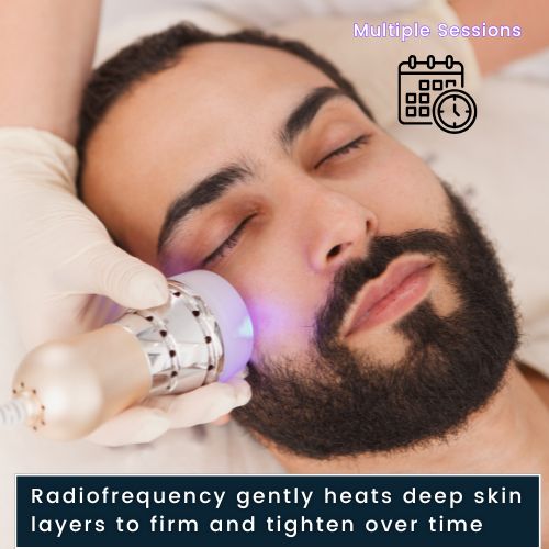 a man's face during radiofrequency treatment, with visual heatwaves showing deeper skin layers being gently heated to boost collagen and tighten skin.