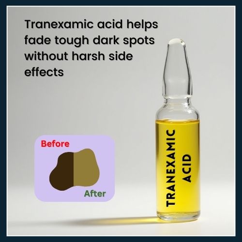 A tranexamic acid serum bottle is shown with a close-up of fading dark spots, representing its use in skincare to reduce pigmentation.