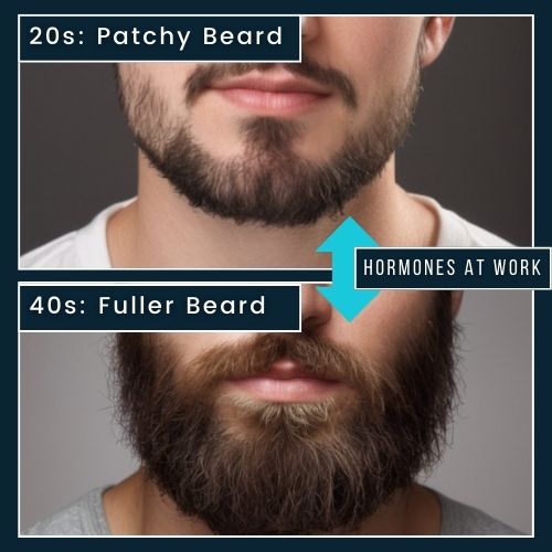 Left Side: a man in his 20s with a noticeably patchy beard labelled “20s: Patchy Beard.” Right Side: a man in his 40s with a fuller, well-defined beard labelled “40s: Fuller Beard.” Connecting Element: an arrow between the two images with a caption “Hormones at Work”