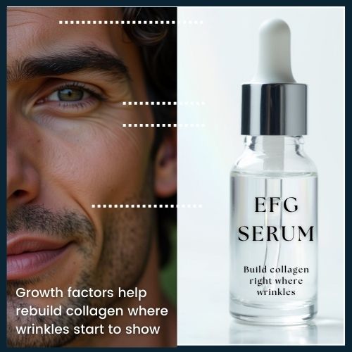 A skincare serum bottle labelled EGF is shown near a man’s face, with visual callouts to common wrinkle areas and an illustration of deeper skin layers to highlight collagen repair.