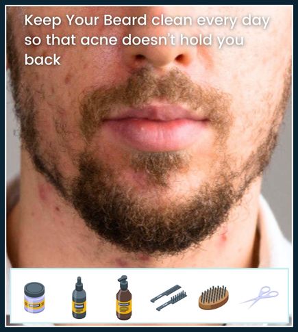 Close-up of a man with active acne and a thick, healthy beard, with a small cleaning icon symbolizing a daily beard-washing routine.