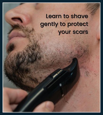 Close-up of a man carefully shaving his face with a clean razor, showing gentle technique over light acne scars.