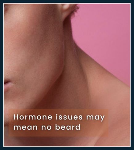 Close up of man's jaw with nearly no beard, symbolizing rare hormone or genetic disorders that limit facial hair growth