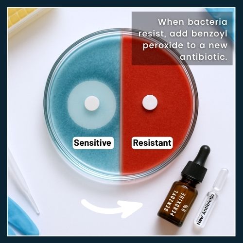 split Petri dish showing a clear inhibition zone on the ‘sensitive’ blue side and no zone on the ‘resistant’ red side, with benzoyl-peroxide and antibiotic vials nearby, illustrating how combination therapy can overcome resistance.