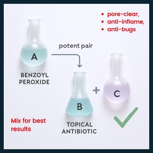 Recipe-style graphic showing benzoyl peroxide + antibiotic + retinoid as the winning acne trio.