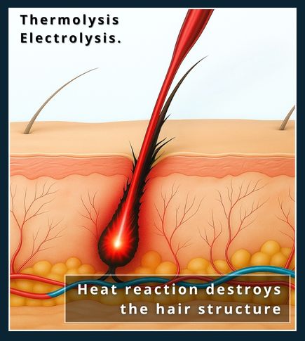 infographic illustrating the flash thermolysis high-heat) of Thermolysis electrolysis