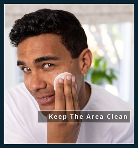 a man standing in the bathroom in front of the mirror is cleansing his face with a cotton disk and mild face cleanser. This illustrates cleansing the treated area of skin after hair removal treatment