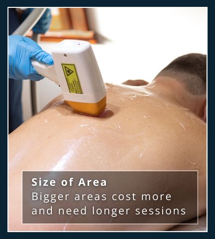 showing a man receiving laser hair treatment on his back, illustrating a common treatment area that may cost more because of the size of the space being treated