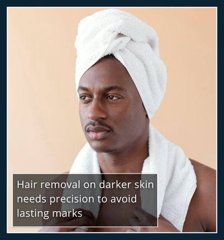 Man with richly pigmented skin examining face for hair removal risks