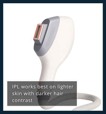 IPL laser handpiece used in hair removal, typically suited to lighter skin types with dark hair contrast