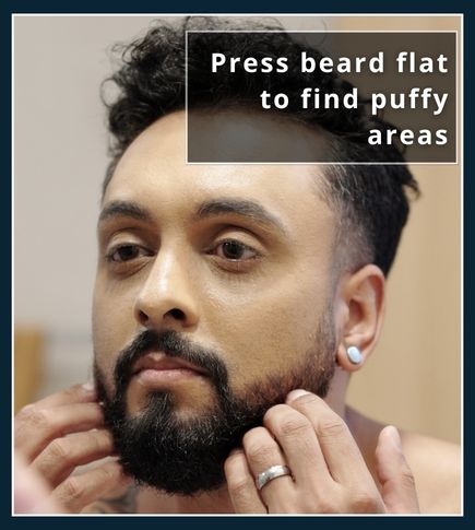 Close‑up of a hand pressing beard hairs flat against the cheek to reveal uneven patches