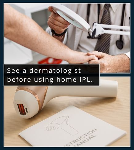 Split image showing a man consulting with a dermatologist and a home IPL device with an instruction manual.