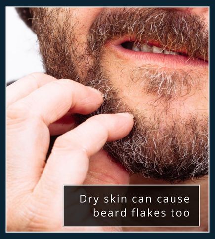 Close-up of a beard with small white flakes from dry skin, not fungal dandruff.