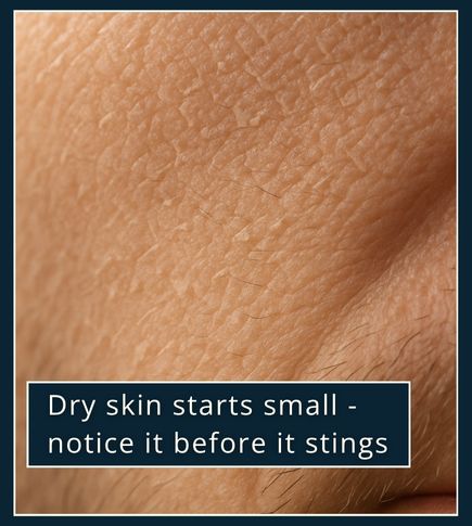 Macro close-up of male skin with mild dryness and matte texture, symbolising early signs of dry skin before irritation appears.