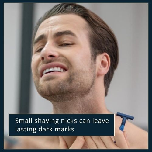 Close-up of a man checking mild shaving irritation on his jawline in front of a mirror, showing how small cuts can cause dark spots.