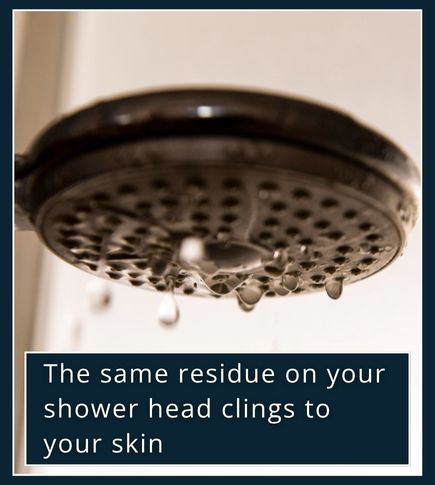 Close-up of hard water stains and mineral residue on a shower head , symbolising how minerals dry out skin.
