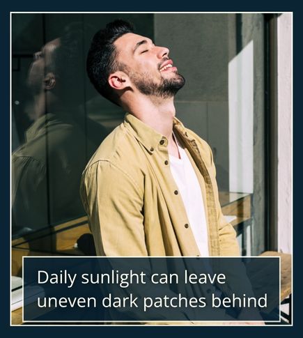 Man standing outdoors in daylight with part of his face in shade, representing how everyday sun exposure can cause dark spots and uneven tone.