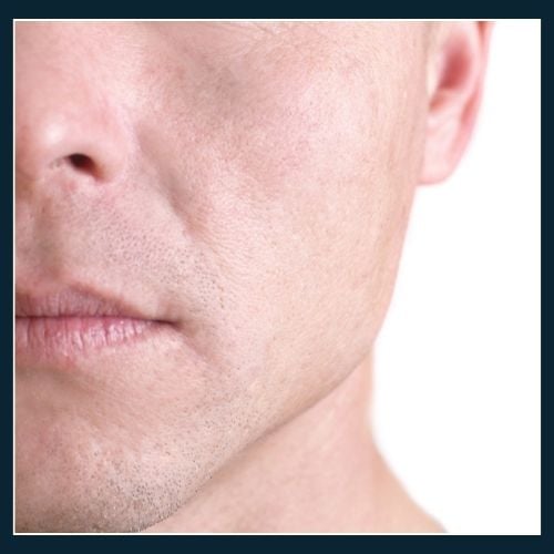 Close up of man with tight and uncomfortable skin after washing his face